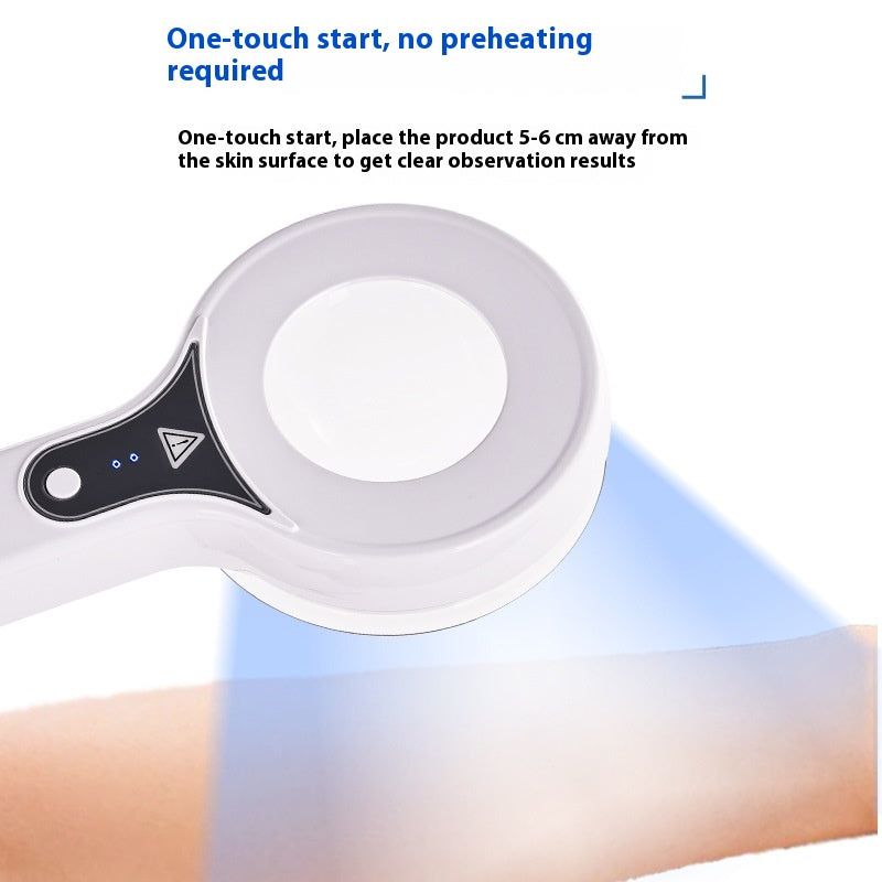 Handheld Household Woods' Light Convenient Skin Detector